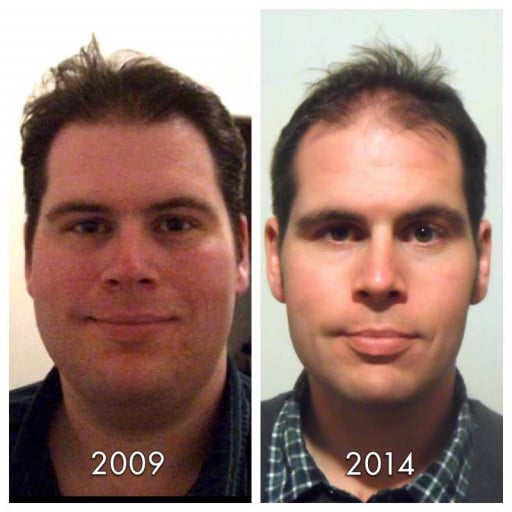 A picture of a 5'10" male showing a weight loss from 394 pounds to 258 pounds. A respectable loss of 136 pounds.