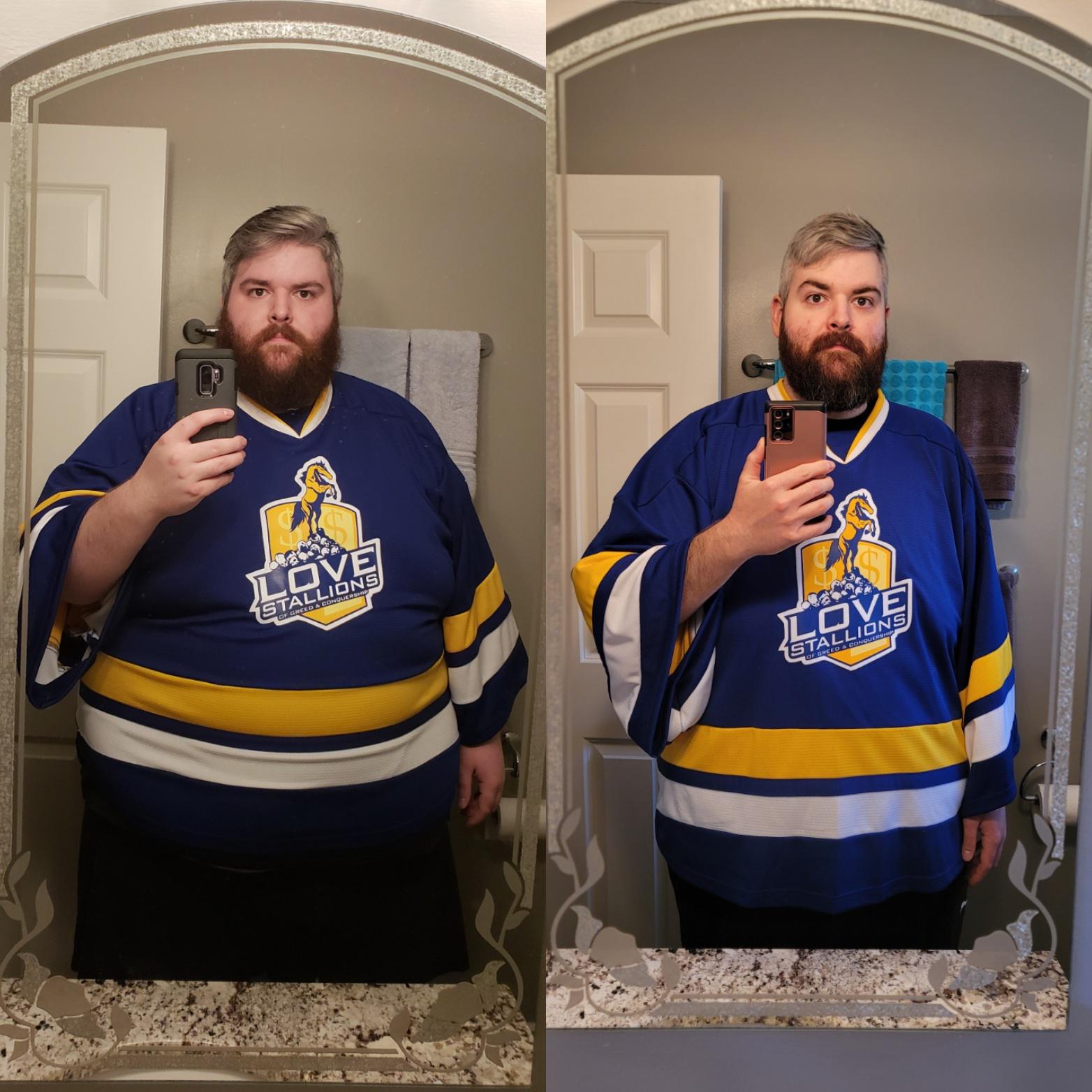 6'2 Male 154 lbs Weight Loss Before and After 469 lbs to 315 lbs