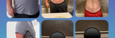192 lbs Weight Loss Before and After 6 foot 2 Male 350 lbs to 158 lbs