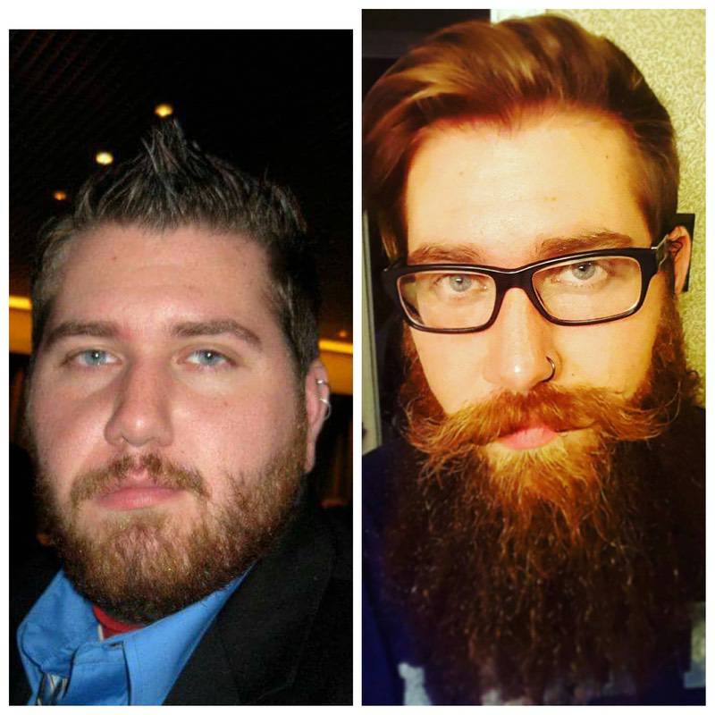 6 feet 3 Male 111 lbs Weight Loss Before and After 334 lbs to 223 lbs