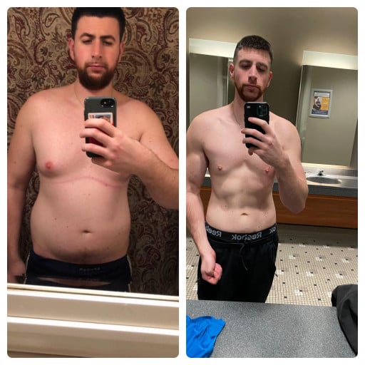A before and after photo of a 6'2" male showing a weight reduction from 215 pounds to 179 pounds. A net loss of 36 pounds.