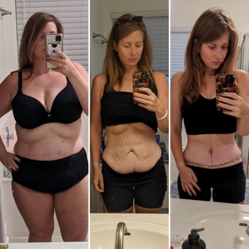 A progress pic of a 5'7" woman showing a fat loss from 265 pounds to 150 pounds. A respectable loss of 115 pounds.