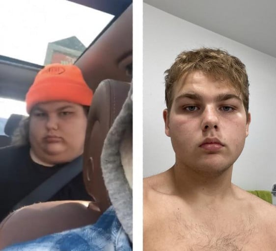 A progress pic of a 5'7" man showing a fat loss from 335 pounds to 194 pounds. A respectable loss of 141 pounds.