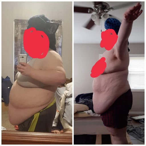 Before and After 75 lbs Fat Loss 5 feet 6 Female 380 lbs to 305 lbs