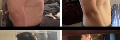 6'3 Male Progress Pics of 86 lbs Weight Loss 318 lbs to 232 lbs