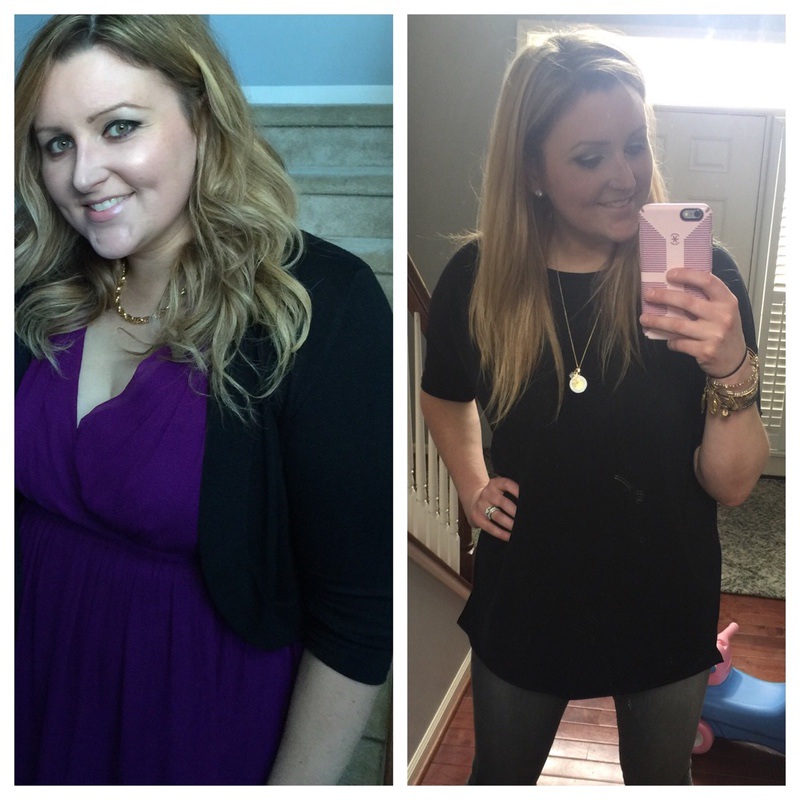 60 lbs Weight Loss Before and After 6 foot Female 240 lbs to 180 lbs