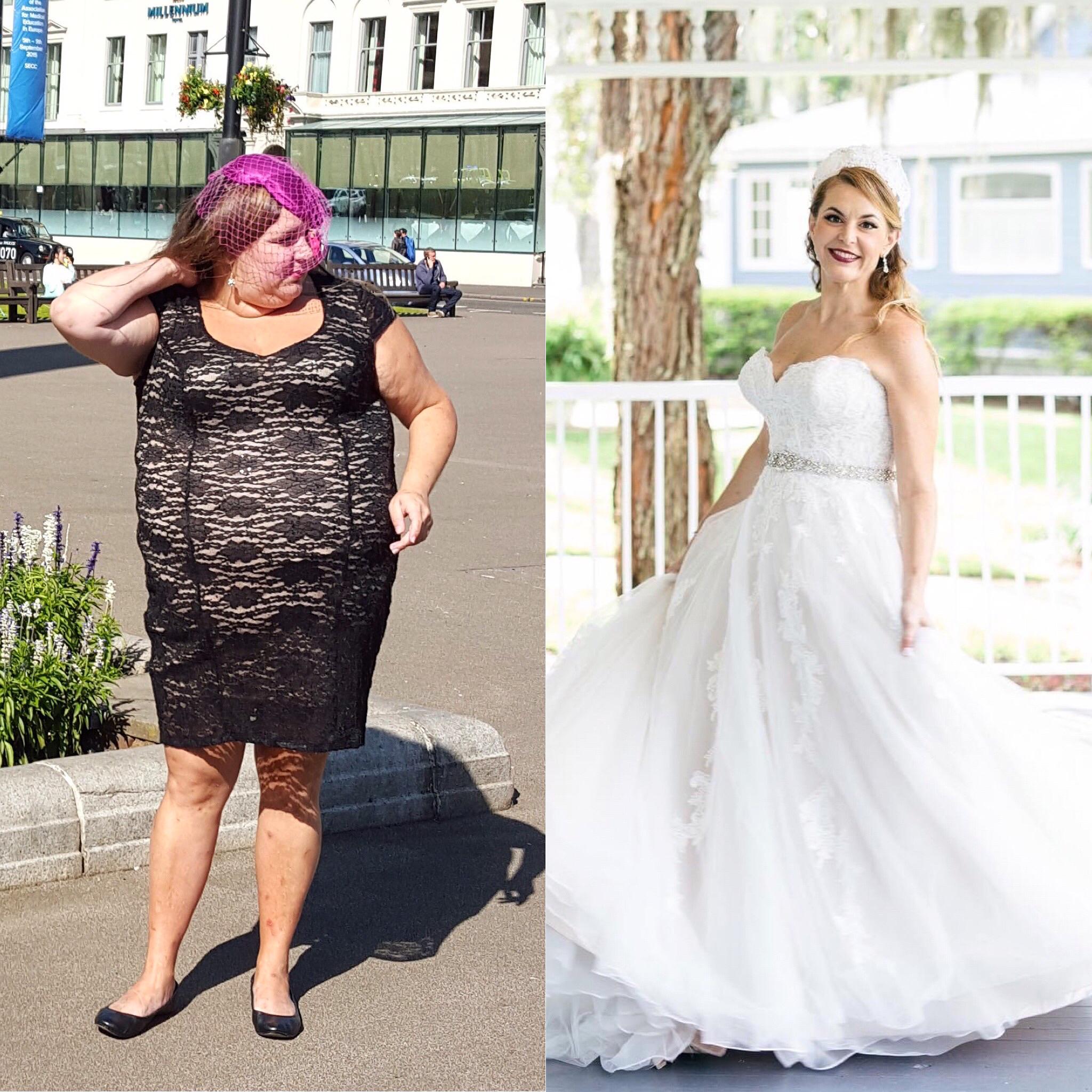 145 lbs Weight Loss 5 feet 7 Female 313 lbs to 168 lbs