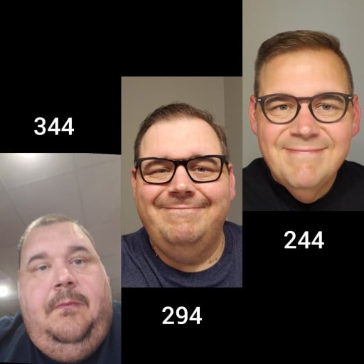 A before and after photo of a 5'10" male showing a weight reduction from 344 pounds to 244 pounds. A net loss of 100 pounds.