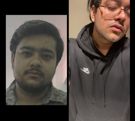 A before and after photo of a 5'7" male showing a weight reduction from 220 pounds to 190 pounds. A net loss of 30 pounds.