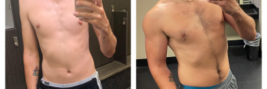 6 foot 1 Male Before and After 54 lbs Weight Gain 130 lbs to 184 lbs