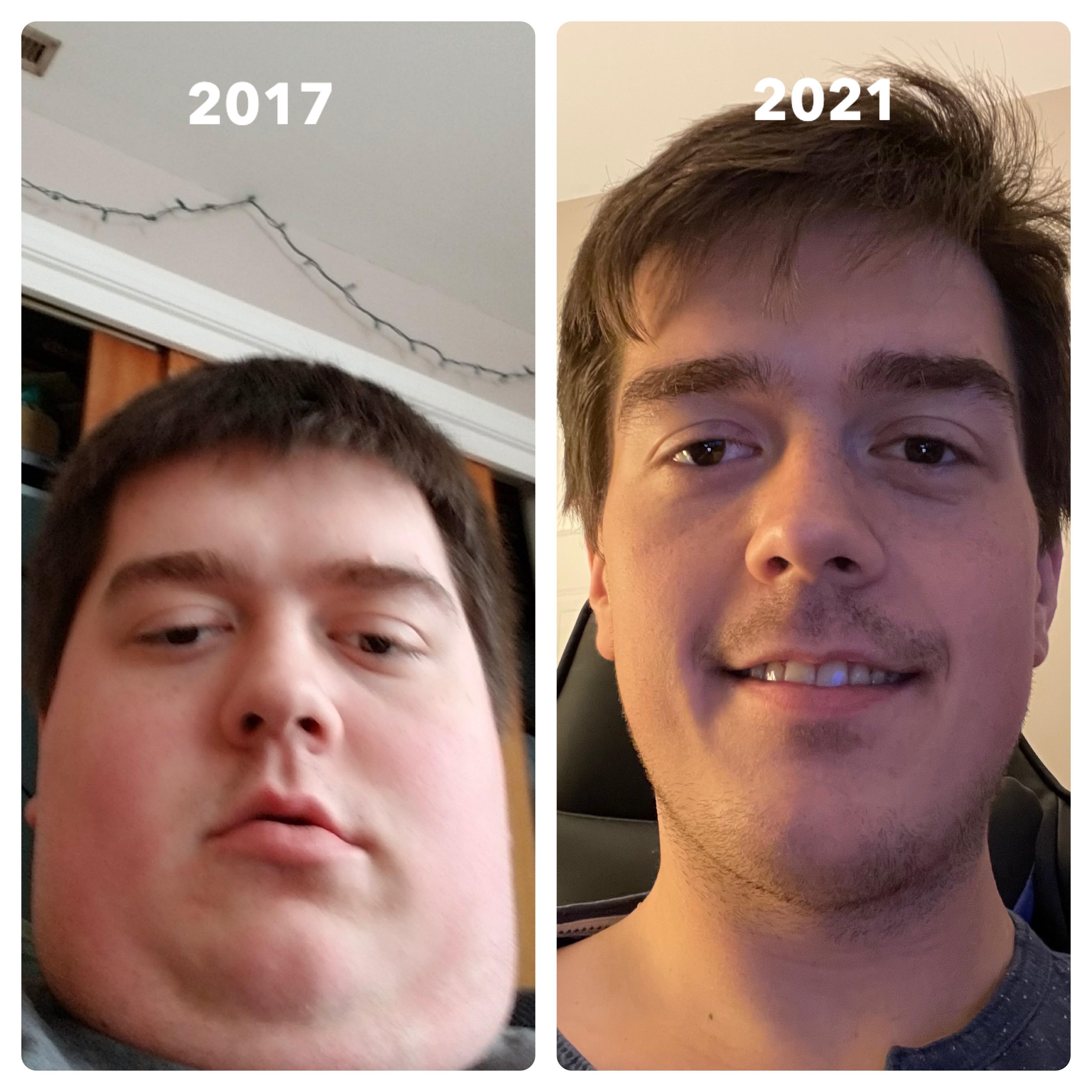 Progress Pics of 140 lbs Fat Loss 6 feet 1 Male 340 lbs to 200 lbs
