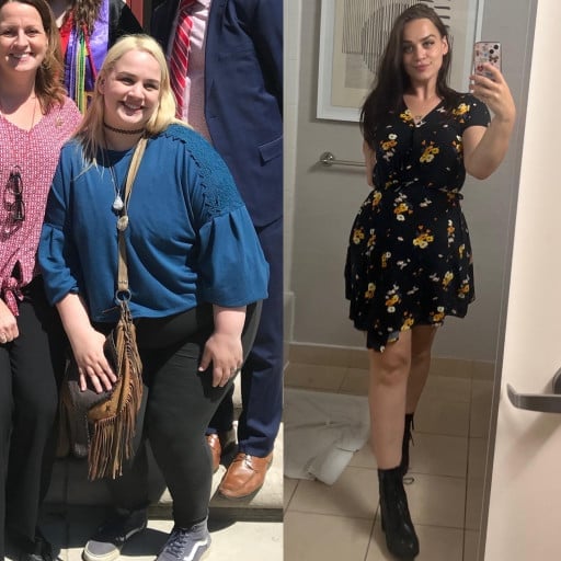 A before and after photo of a 5'4" female showing a weight reduction from 260 pounds to 110 pounds. A net loss of 150 pounds.