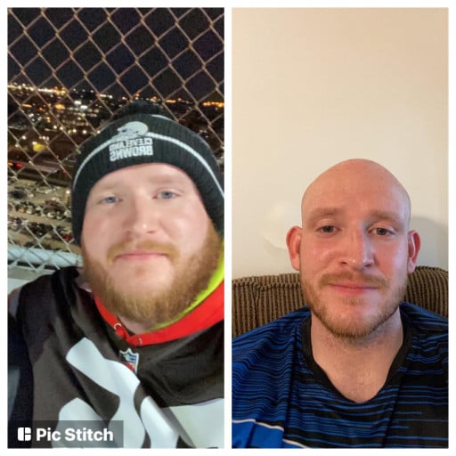 M/30/6’0 [323lbs.-263lbs.=60 lbs. lost] (5 months) Left picture is from late November 2021, right is today. Started losing weight January 10th, 2022. The body progress has been great, but the face gains are awesome.