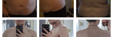 5'11 Male Before and After 98 lbs Weight Loss 280 lbs to 182 lbs