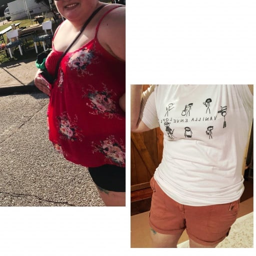 A before and after photo of a 5'6" female showing a weight reduction from 330 pounds to 228 pounds. A net loss of 102 pounds.