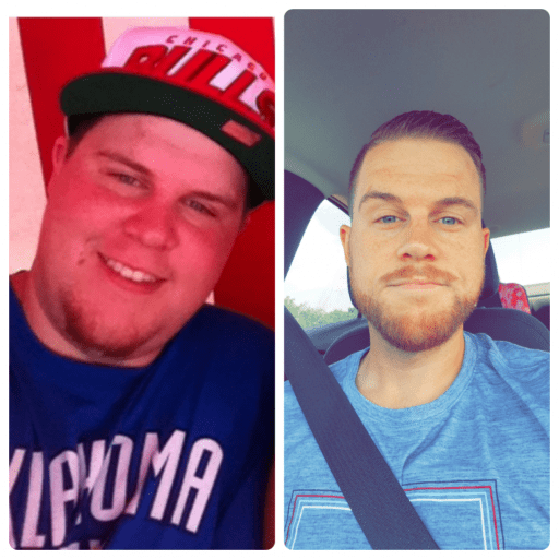 5'9 Male Before and After 81 lbs Weight Loss 260 lbs to 179 lbs