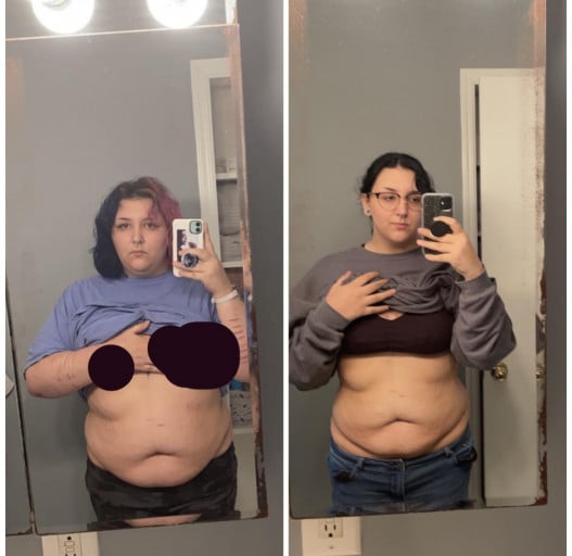 5 foot 8 Female 70 lbs Weight Loss 277 lbs to 207 lbs