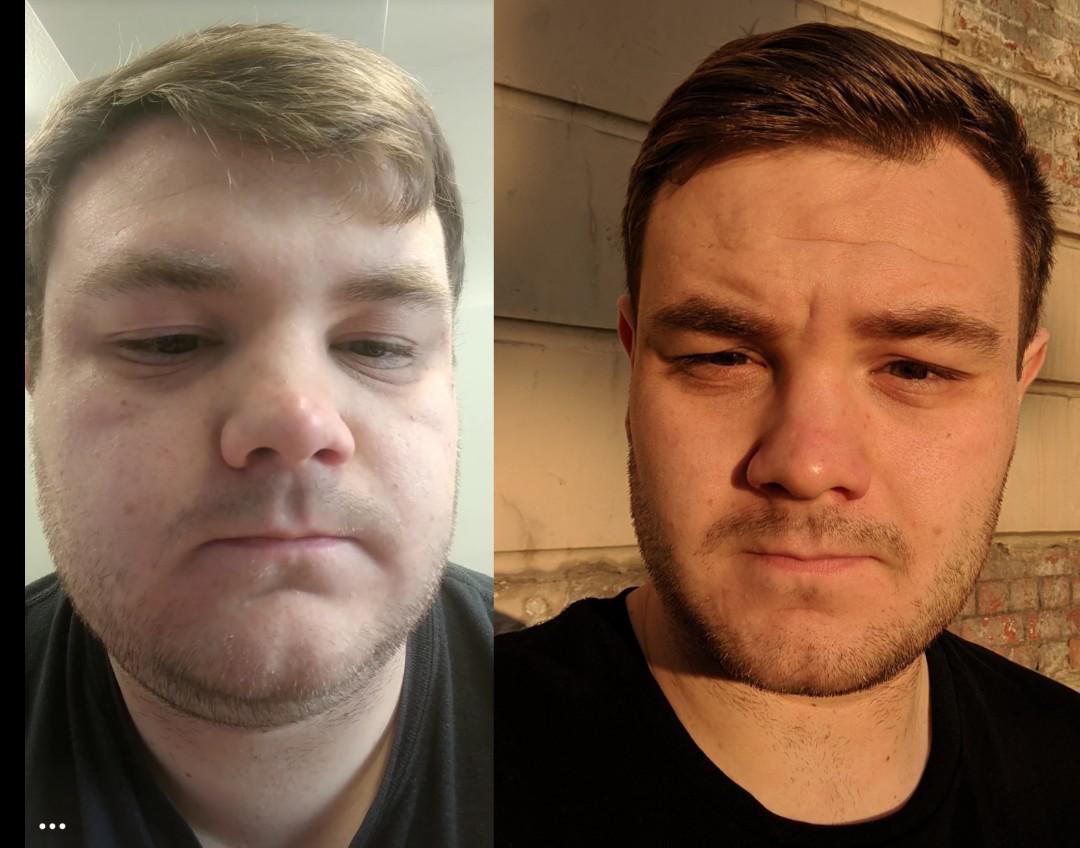 Before and After 81 lbs Fat Loss 5 foot 10 Male 282 lbs to 201 lbs