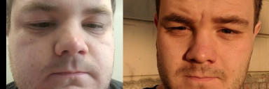 Before and After 81 lbs Fat Loss 5 foot 10 Male 282 lbs to 201 lbs