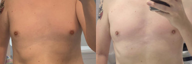 6 foot 8 Male 28 lbs Weight Loss Before and After 245 lbs to 217 lbs