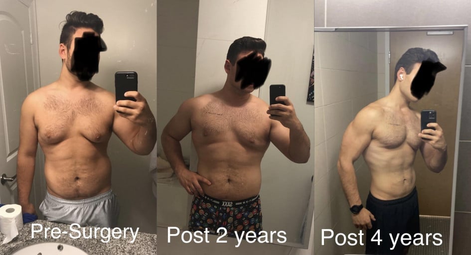 Before and After 90 lbs Fat Loss 6 foot Male 285 lbs to 195 lbs
