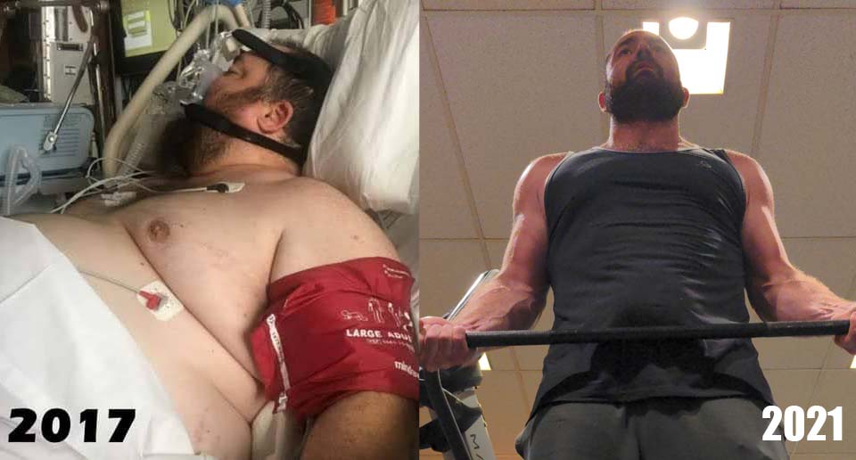 6 foot Male Progress Pics of 200 lbs Fat Loss 430 lbs to 230 lbs