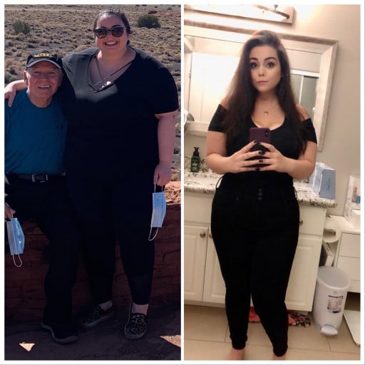 A picture of a 5'4" female showing a weight loss from 310 pounds to 175 pounds. A respectable loss of 135 pounds.