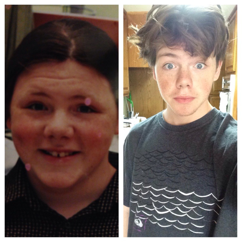Progress Pics of 66 lbs Weight Loss 5'6 Male 205 lbs to 139 lbs