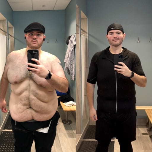 A before and after photo of a 6'0" male showing a weight reduction from 525 pounds to 240 pounds. A net loss of 285 pounds.