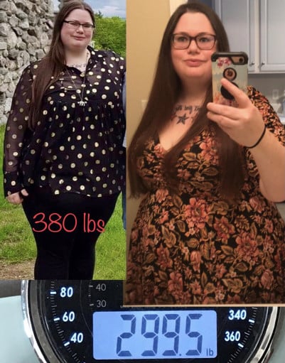 A progress pic of a 5'6" woman showing a fat loss from 380 pounds to 299 pounds. A total loss of 81 pounds.