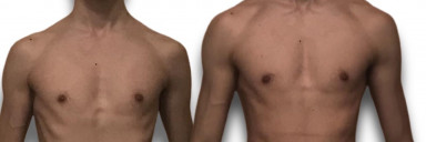 6 foot 1 Male 11 lbs Weight Gain Before and After 129 lbs to 140 lbs