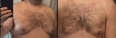 5'7 Male 78 lbs Weight Loss Before and After 247 lbs to 169 lbs
