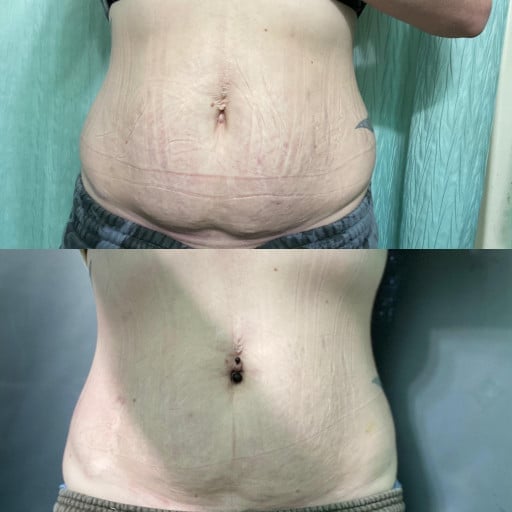 Progress Pics of 56 lbs Weight Loss 5'6 Female 202 lbs to 146 lbs