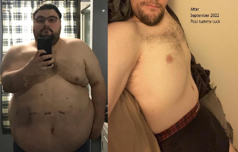 A picture of a 5'11" male showing a weight loss from 487 pounds to 226 pounds. A net loss of 261 pounds.