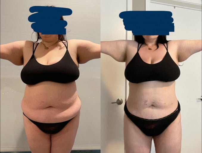 A picture of a 5'7" female showing a weight loss from 283 pounds to 247 pounds. A net loss of 36 pounds.