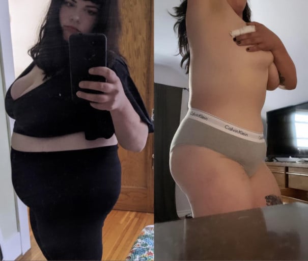 A picture of a 5'5" female showing a weight loss from 285 pounds to 198 pounds. A net loss of 87 pounds.