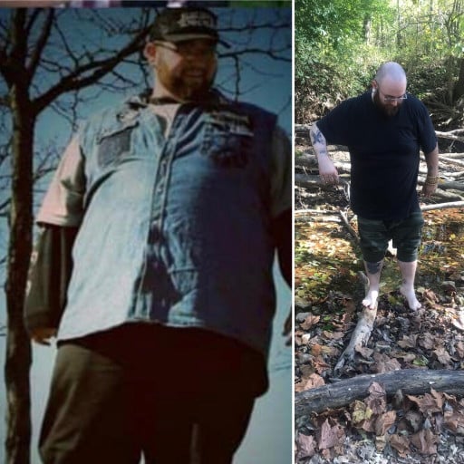 A picture of a 6'4" male showing a weight loss from 595 pounds to 325 pounds. A respectable loss of 270 pounds.