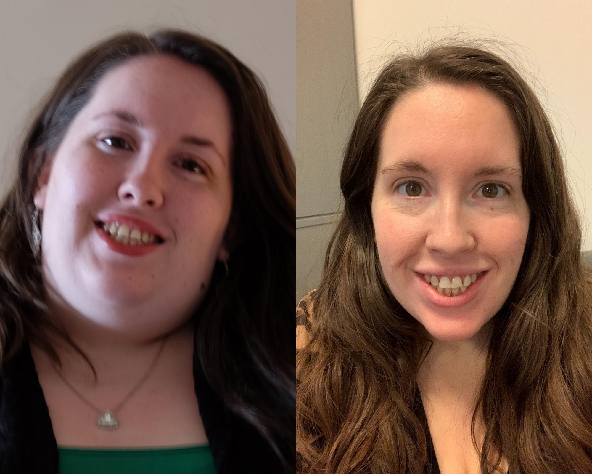 5 foot Female 90 lbs Weight Loss 243 lbs to 153 lbs