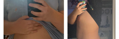 5 foot 6 Male 80 lbs Weight Loss Before and After 270 lbs to 190 lbs