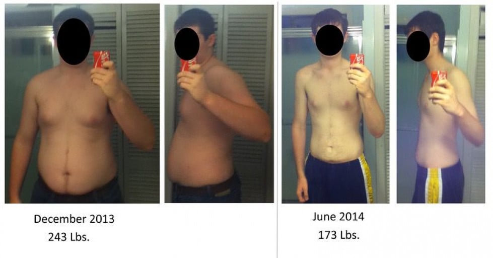 Teen Makes Impressive Progress on Weight Loss Journey Sheds 70 Lbs in 6 Months