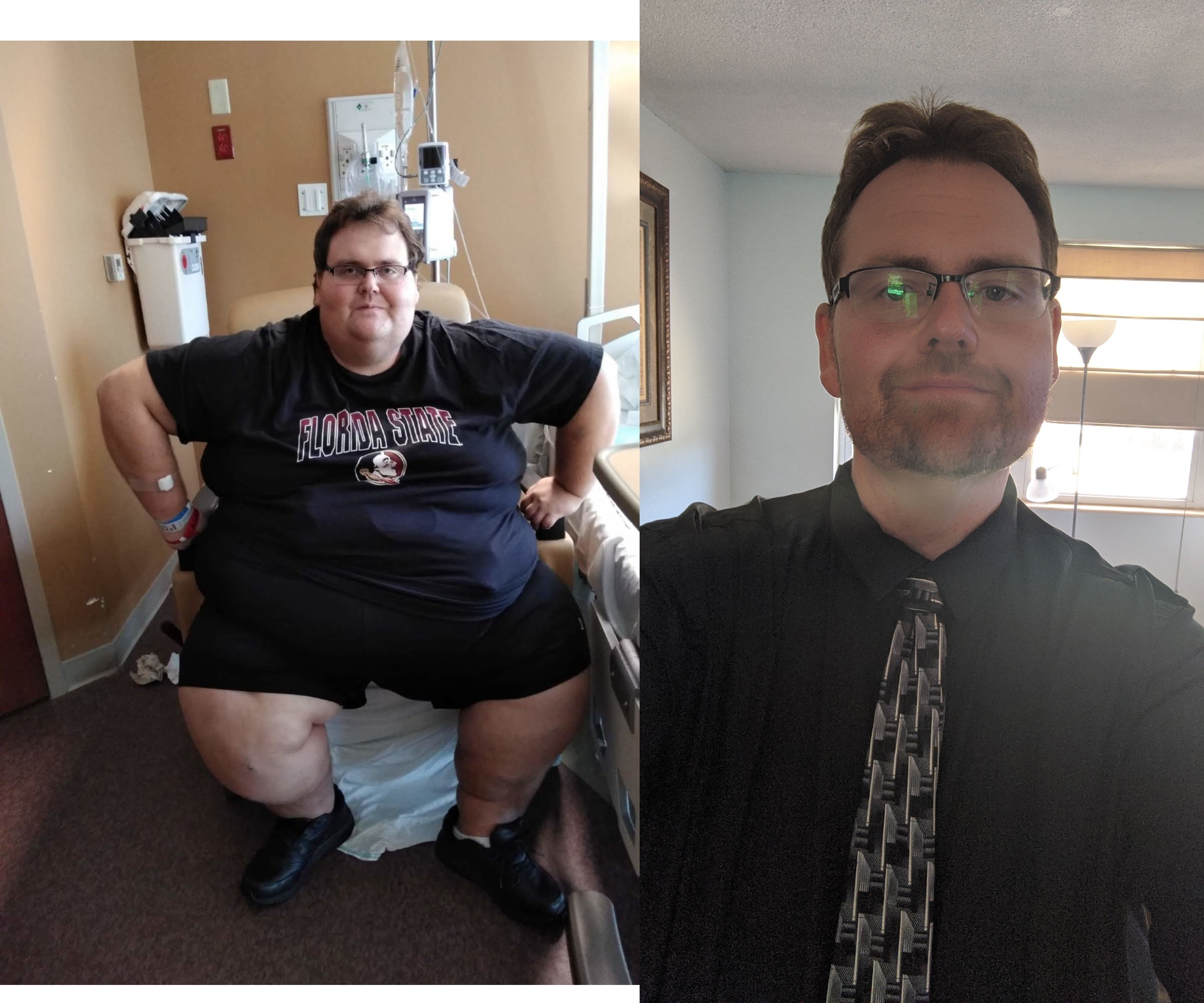 6 foot Male 322 lbs Fat Loss 587 lbs to 265 lbs