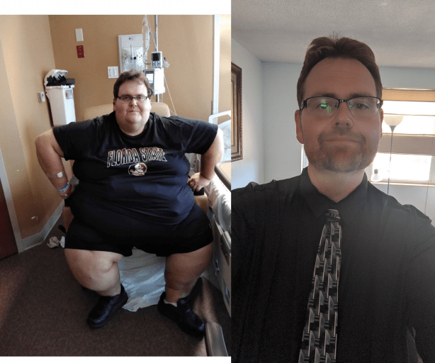 A picture of a 6'0" male showing a weight loss from 587 pounds to 265 pounds. A net loss of 322 pounds.