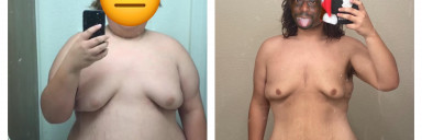 100 lbs Weight Loss Before and After 5'10 Male 300 lbs to 200 lbs