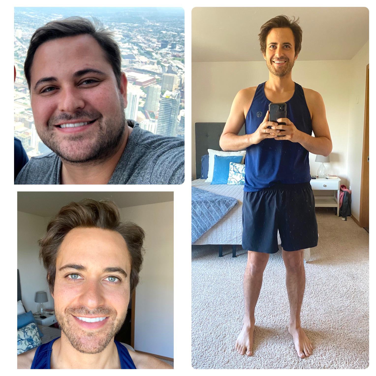 122 lbs Weight Loss Before and After 5 feet 10 Male 282 lbs to 160 lbs