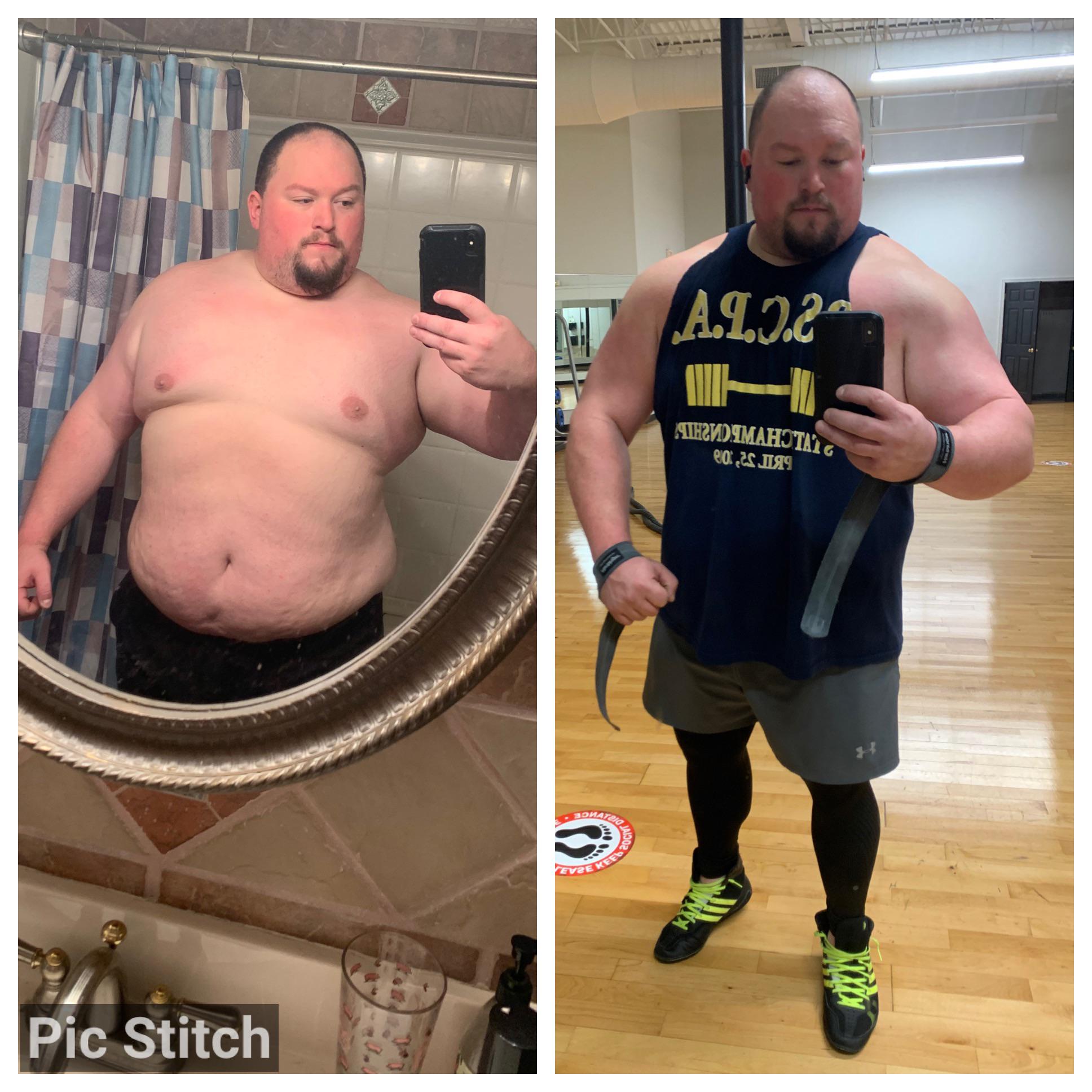 5 foot 10 Male Before and After 70 lbs Fat Loss 390 lbs to 320 lbs