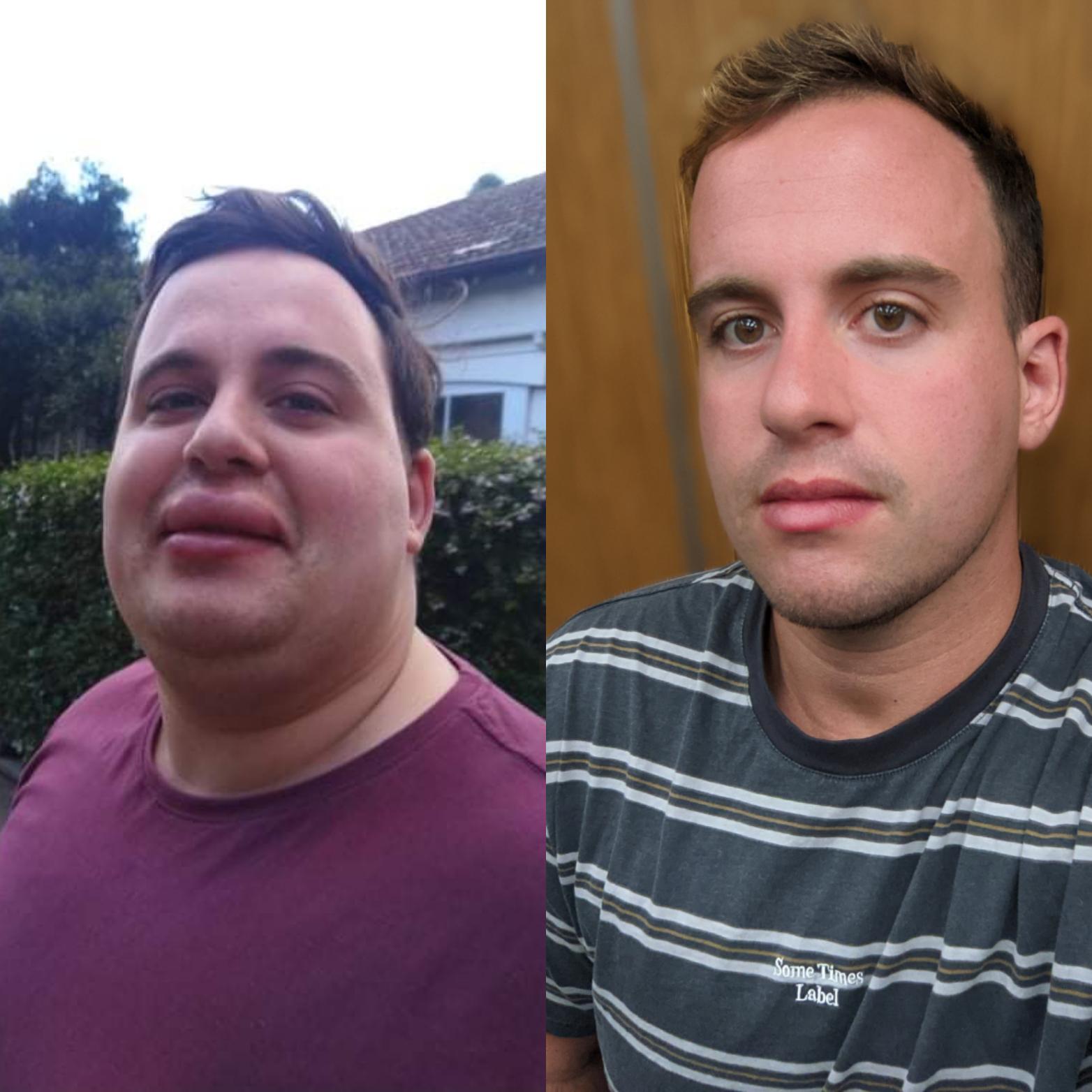 6 feet 1 Male Progress Pics of 135 lbs Weight Loss 350 lbs to 215 lbs