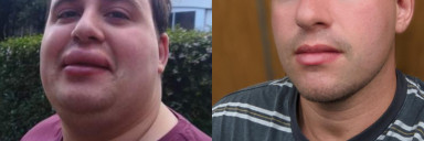 135 lbs Weight Loss Before and After 6'1 Male 350 lbs to 215 lbs