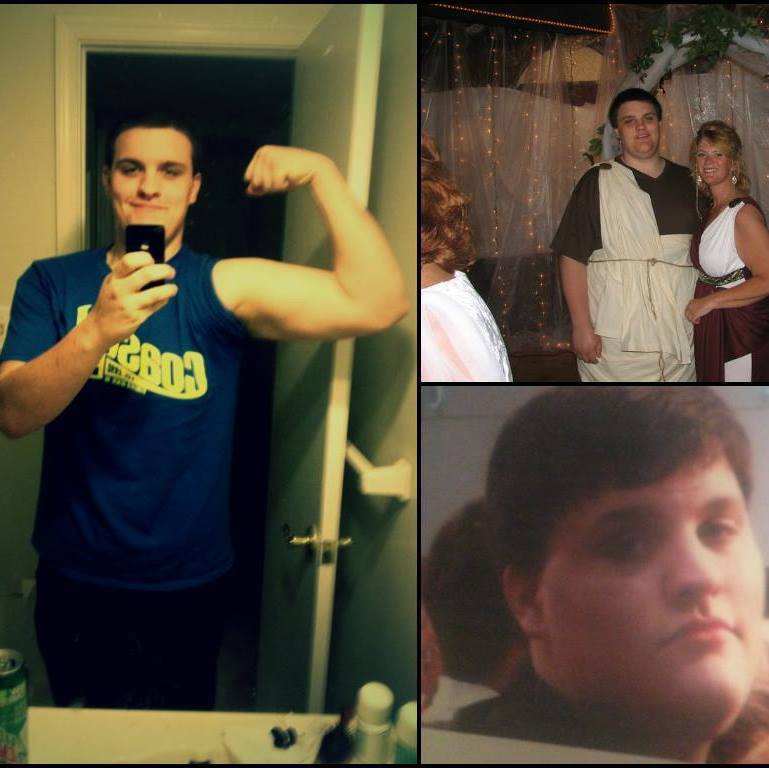 6 foot Male Before and After 142 lbs Weight Loss 350 lbs to 208 lbs
