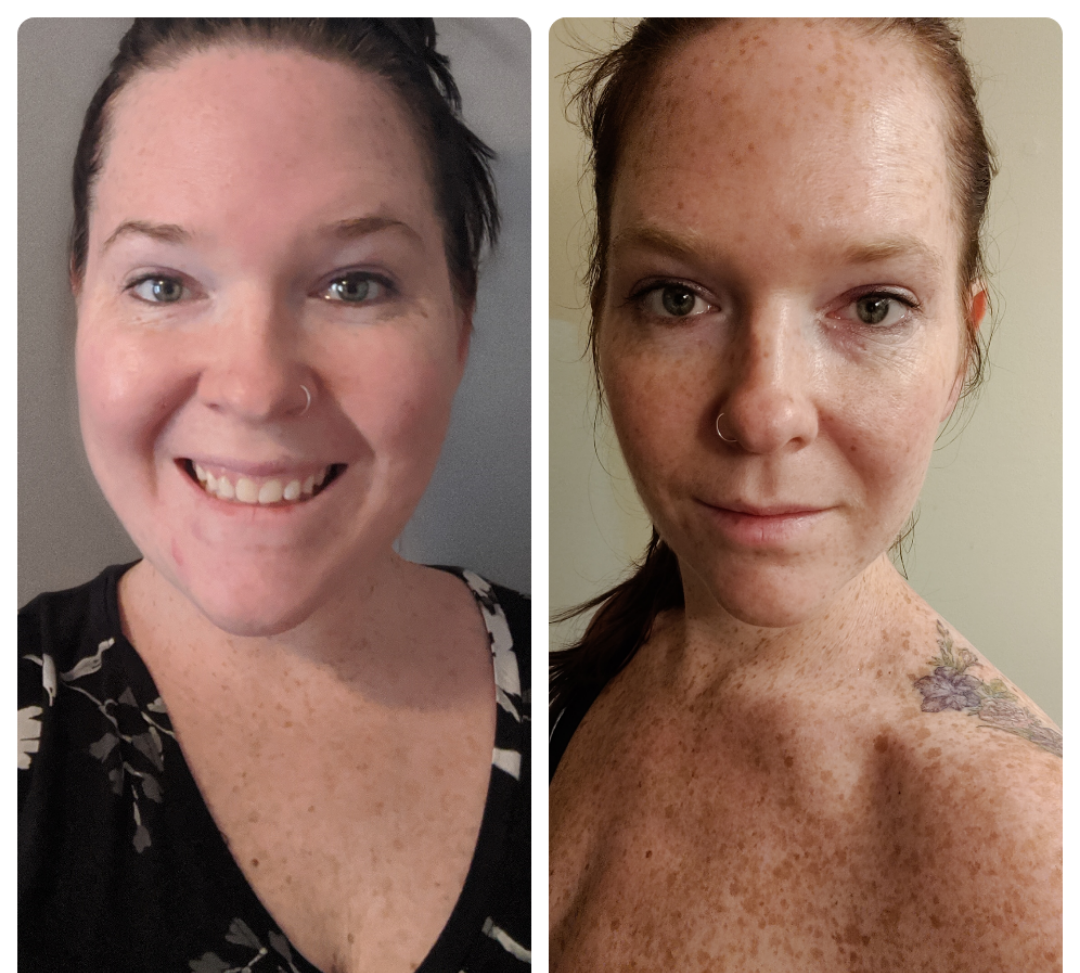 107 lbs Fat Loss Before and After 5 feet 9 Female 266 lbs to 159 lbs