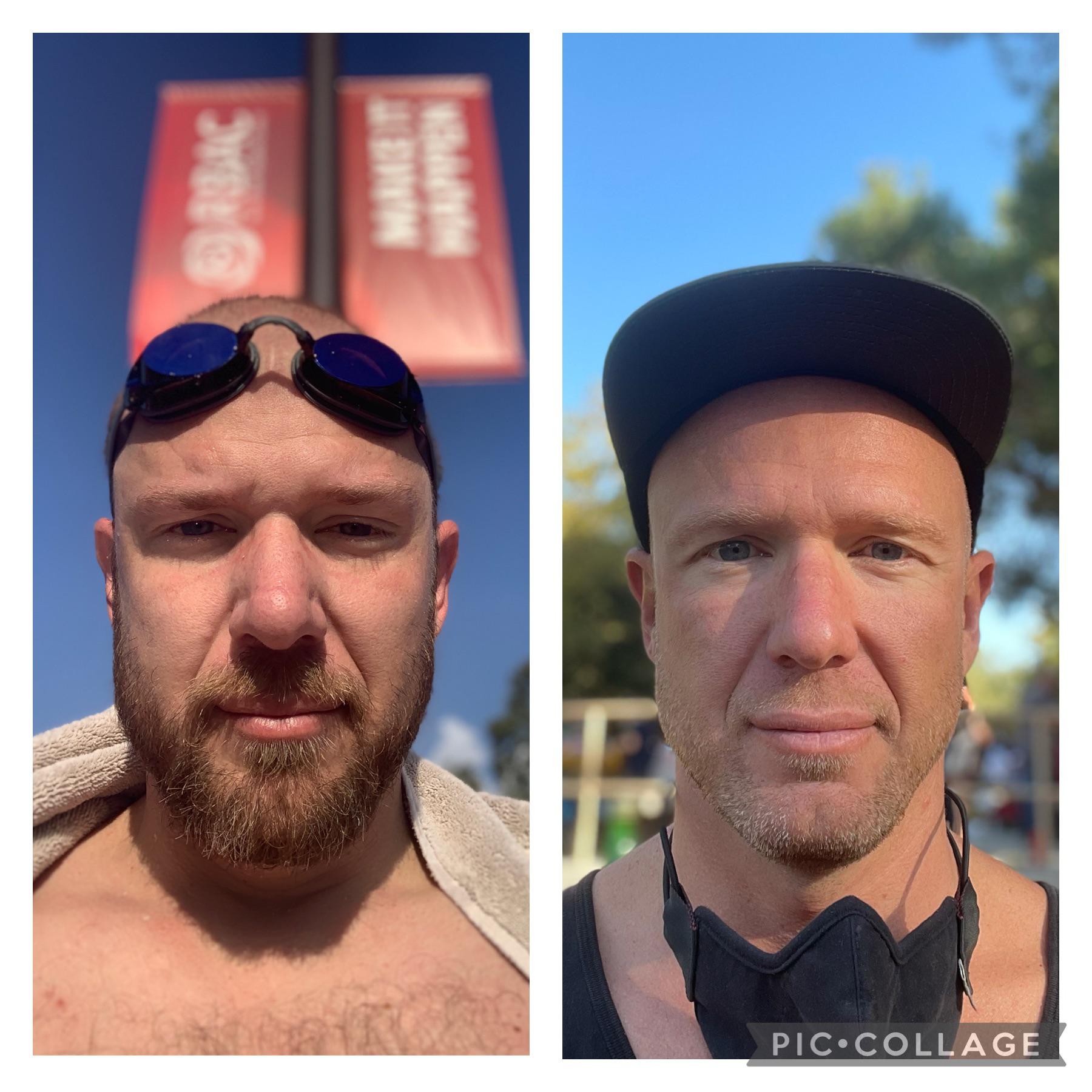 10 lbs Fat Loss Before and After 6 foot Male 178 lbs to 168 lbs